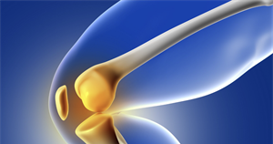 Ενέσεις Υαλουρονικού Οξέος στο Γόνατο: Είναι αποτελεσματικές;